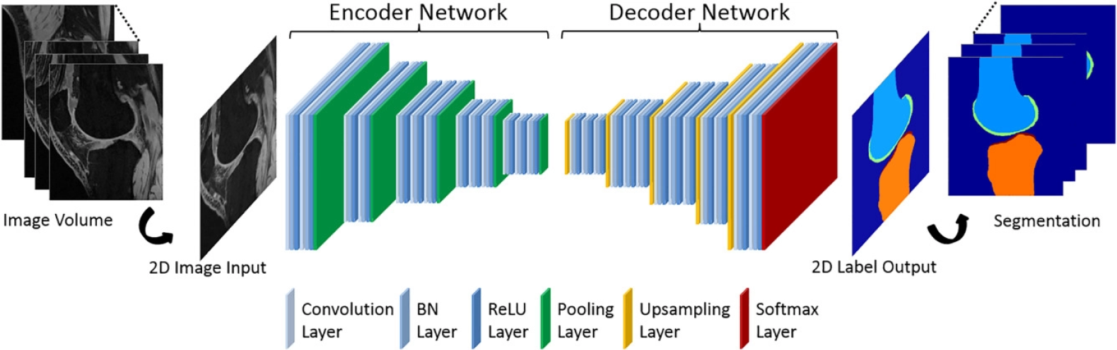 Get a visual understanding of the Neural Network Architecture for Image Segmentation and how it works to separate objects and background in an image.