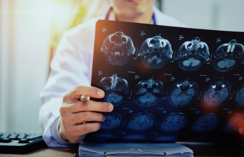 Medical Imaginary Diagnosis using AI/ML